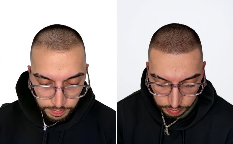 Before and after scalp micropigmentation by Karl: adding density to short hair